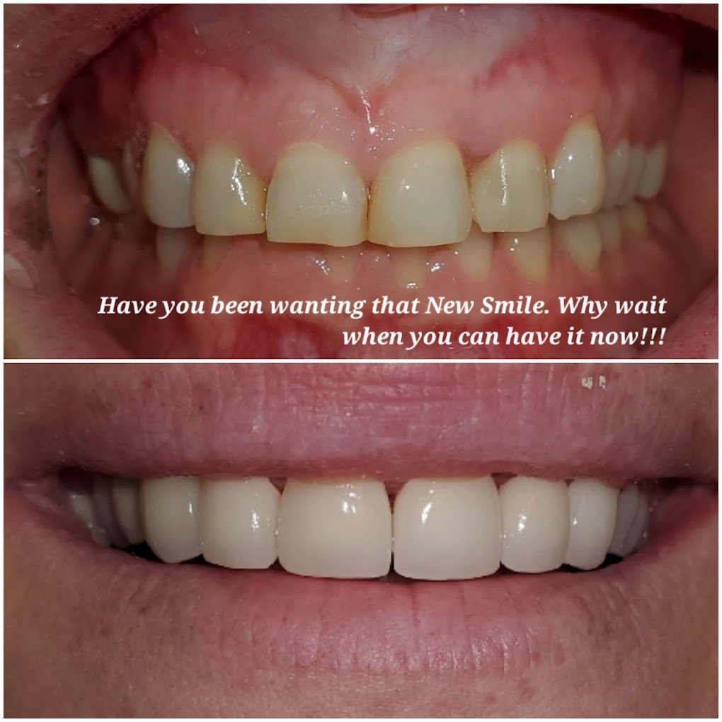 Beautiful smile transformation