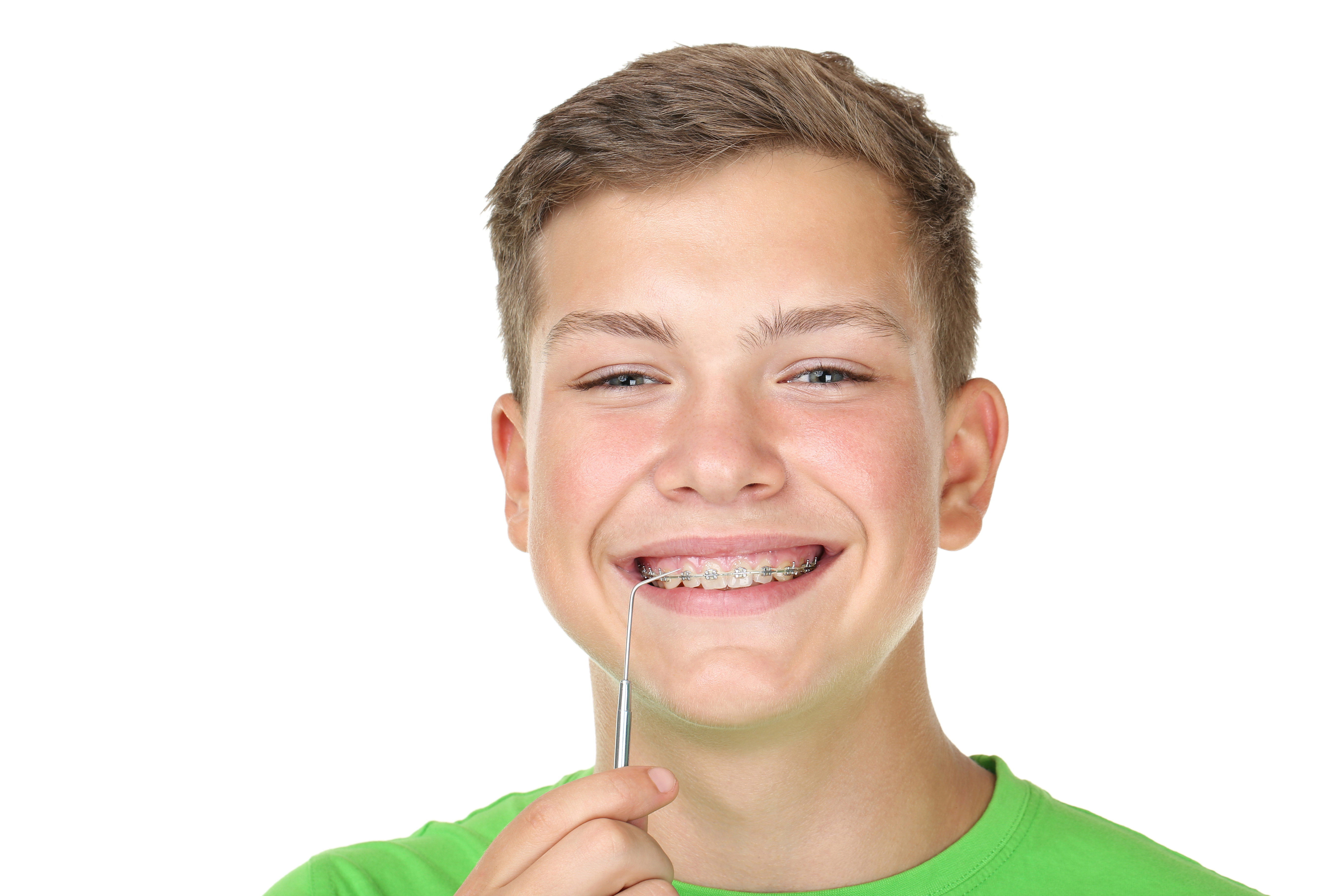 Traditional braces
