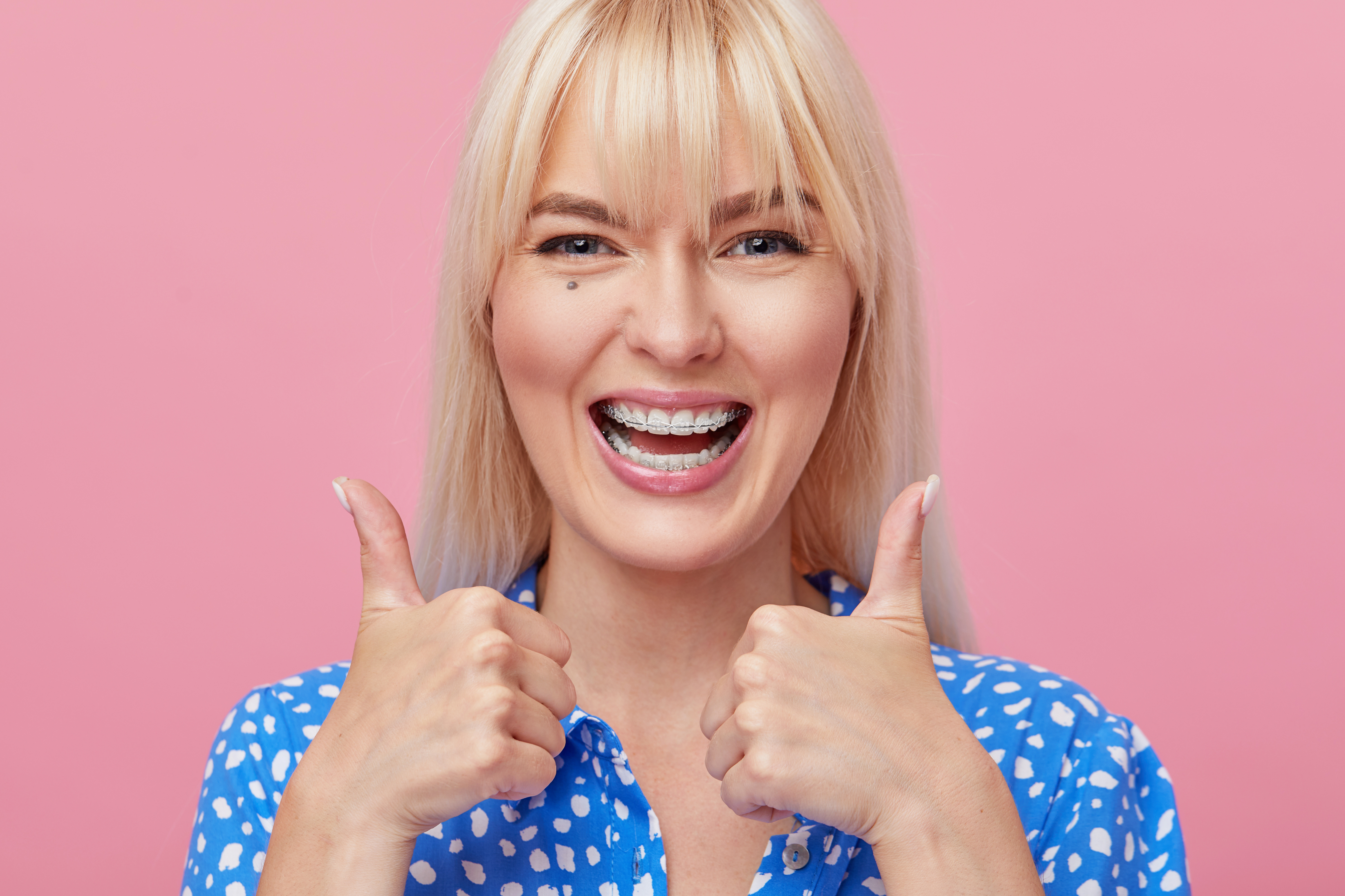 Clear ceramic braces Corona