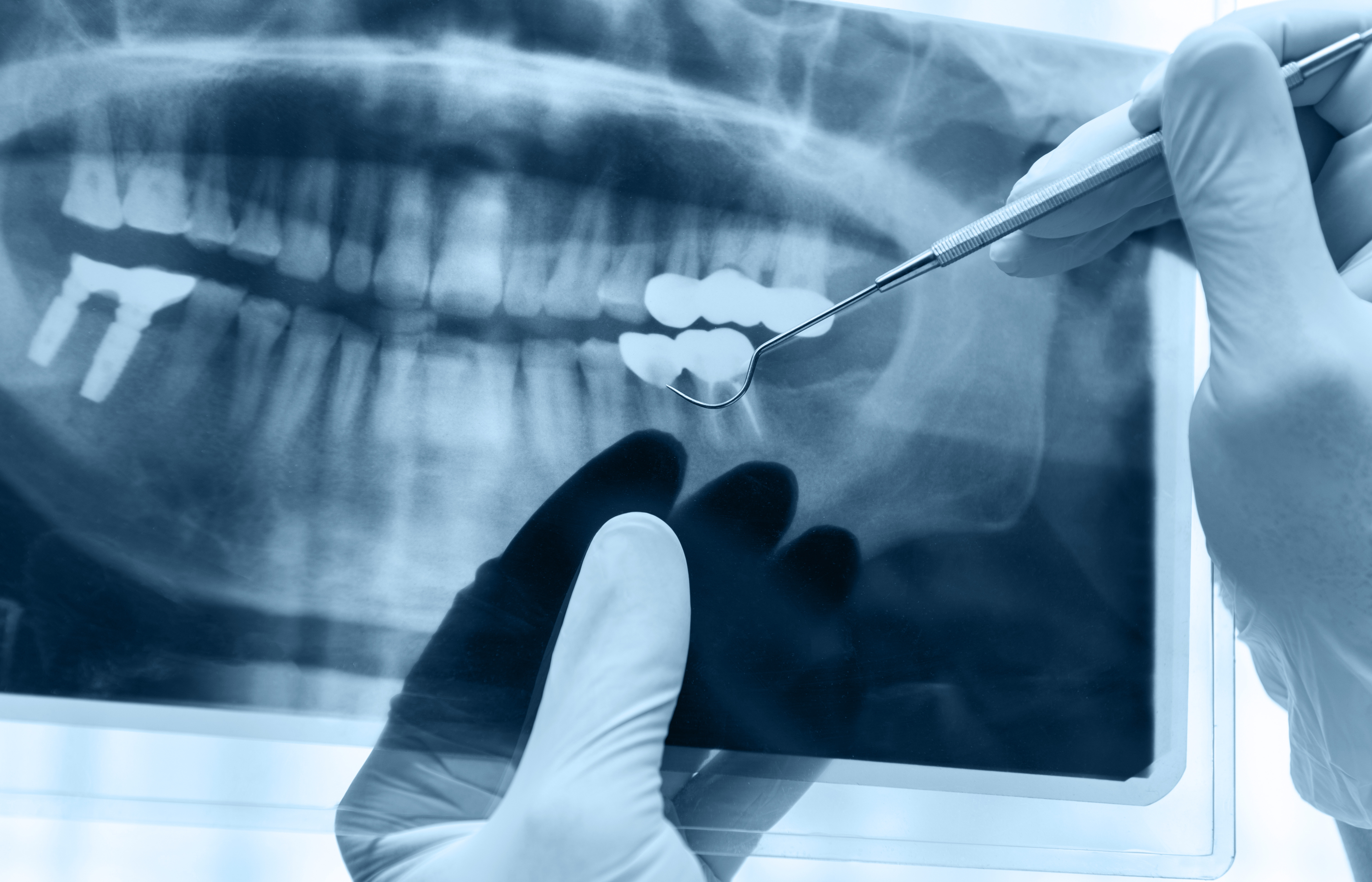 Digital dental x-ray technology